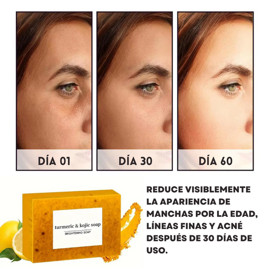 NATURSOAP: Jabón de Cúrcuma Natural para Aclarar la Piel