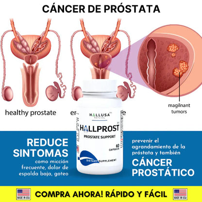 HALLPROST - TRATAMIENTO PARA LA PROSTATA